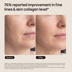 “76% reported improvement in fine lines & skin collagen level*” before-and-after facial comparison.