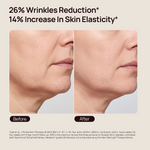 26% Wrinkles Reduction*; 14% Increase In Skin Elasticity*. Before-and-after close-up of facial skin.