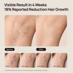 Before-and-after underarm photos show visibly reduced hair growth over 4 weeks, with text “18% Reported Reduction Hair Growth.”