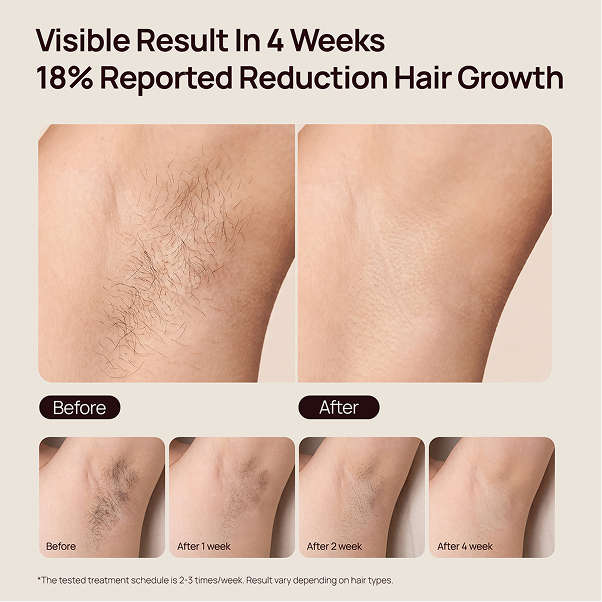 Before-and-after underarm photos show visibly reduced hair growth over 4 weeks, with text “18% Reported Reduction Hair Growth.”