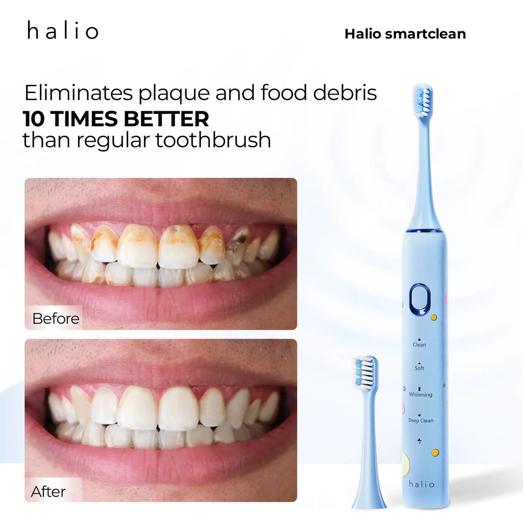 Halio Sonic SmartClean Electric Toothbrush (Spring Breeze) - Eliminates plaque and food debris "10 times better" than regular toothbrush - Before and after picture