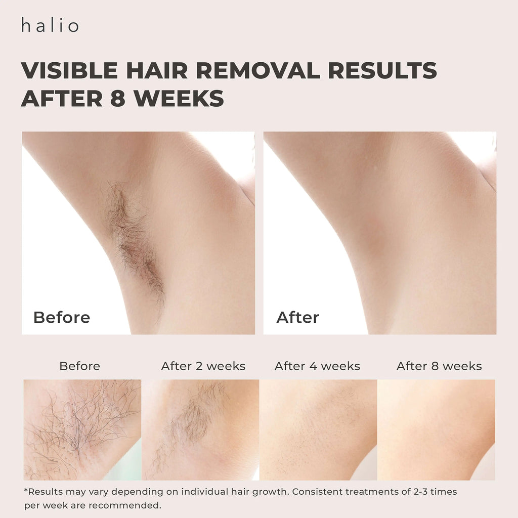 HALIO IPL COOLING HAIR REMOVAL DEVICE - VISIBLE HAIR REMOVAL RESULTS AFTER 8 WEEKS